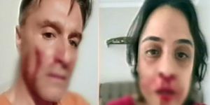 Hazım Körmükçü ve Zeynep Tandoğan birbirini dövmüş!