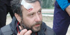Nejat İşler hayranının kocası tarafından darp edildi