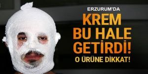 Erzurum'da Merdiven Altı Krem Bu Hale Getirdi