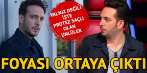 Oğuzhan Koç protez saç yaptırdı