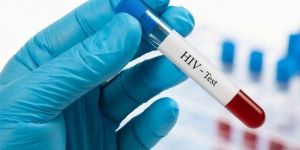 Türkiye’de HIV pozitif sayısı arttı