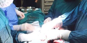 Sigara kullananlarda risk 4 kat fazla