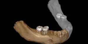 Tek bir dişten büyük bir sır keşfedildi