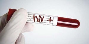 Yeni HIV türü keşfedildi
