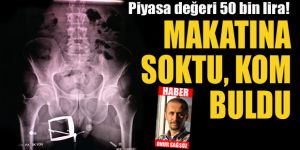 İranlı kadının şok eden uyuşturucu taşıma yöntemini polis fark etti