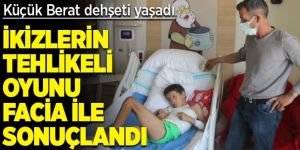 Sosyal medyada izledi, ikizini yaktı