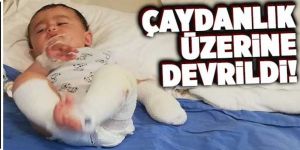 Çay keyfi, 10 aylık bebeği yaktı