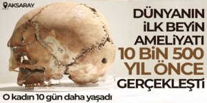 Dünyanın ilk beyin ameliyatı 10 bin 500 yıl önce yapıldı