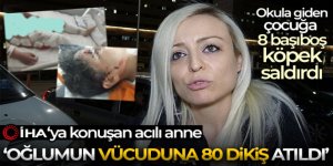 Okula giden 10 yaşındaki çocuğa başıboş 8 köpek saldırdı, 80 dikiş atıld