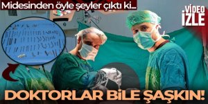 Doktorları şaşkına çeviren ameliyat: Midesinden 158 parça metal çıktı