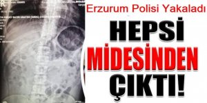 Erzurum'da polis şaştı kaldı: Hepsini yutmuşlar
