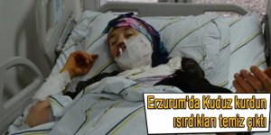 Erzurum'da Kuduz kurdun ısırdıkları temiz çıktı
