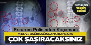 Erzurum Polisinden kaçamadı: Mide ve bağırsağından 78 kapsül çıktı