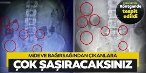 Erzurum polisinden kaçamadı: İç organlarına zulalamış