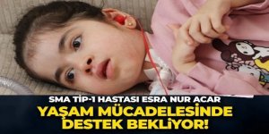 Yaşamak için aç kalıyor.... Zaman daraldı!