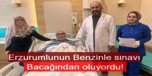 Bidondaki benzini ateşle test edince, bacağından oluyordu!