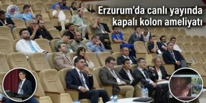 Erzurum'da canlı yayında kapalı kolon ameliyatı
